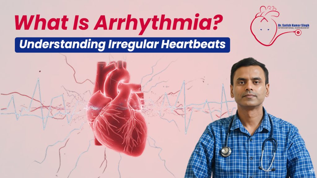 What Is Arrhythmia
